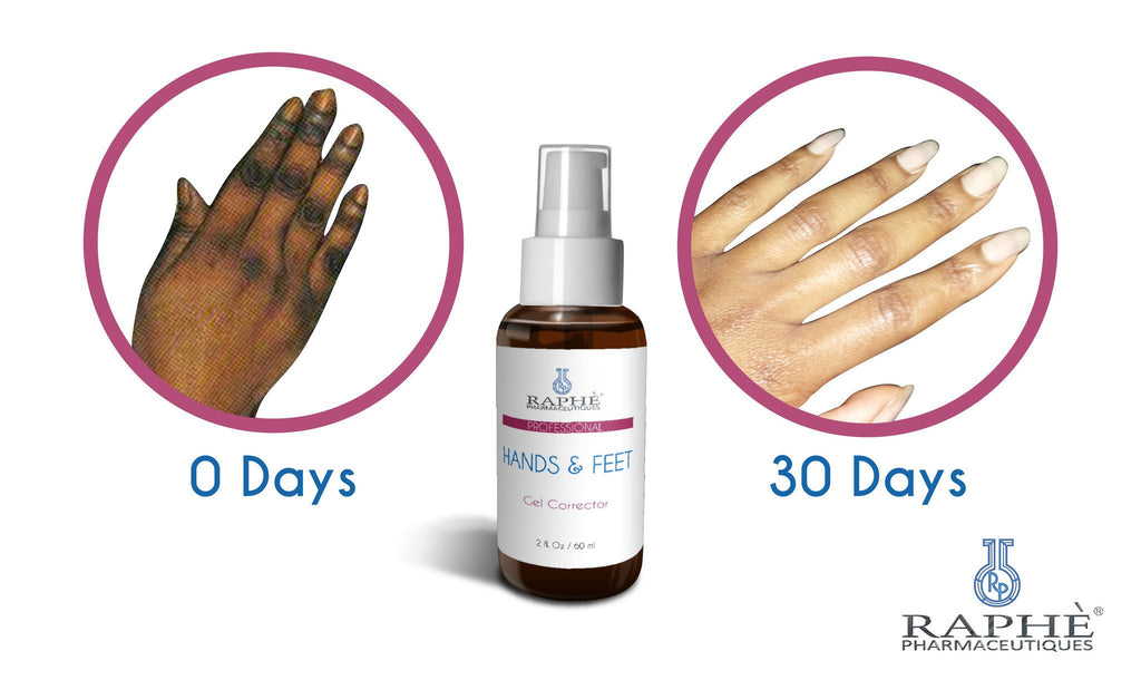 Private Label Best Skin Bleach Regimen For Hands, Feet Treatment, Knuckles, Elbows and Heels